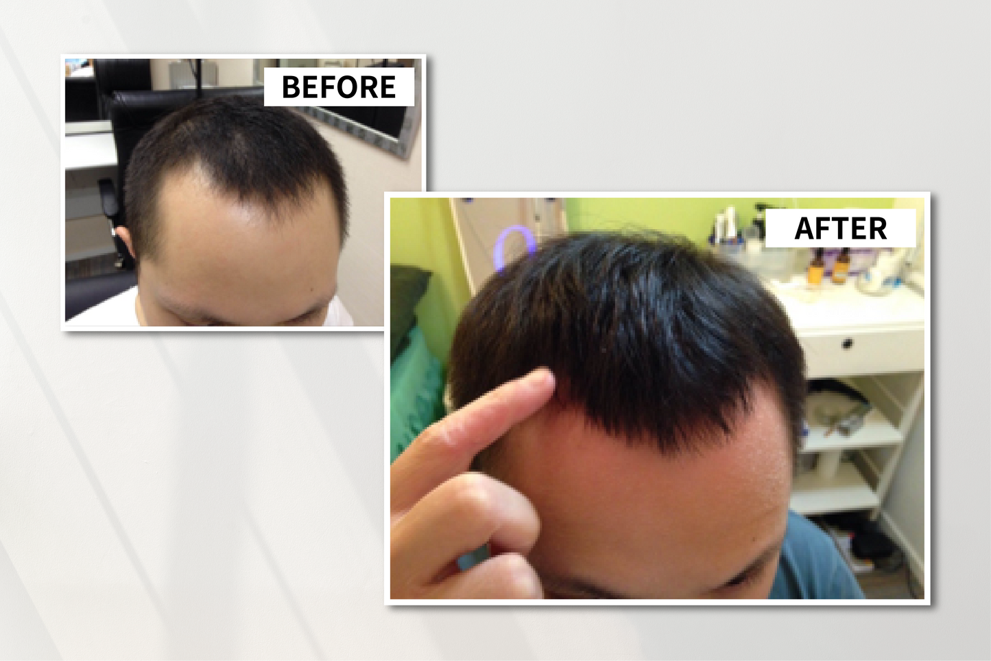 DrD 深層防斷髮修護霜 Anti-Hair-Loss Anti-Breaking Treatment Conditioner