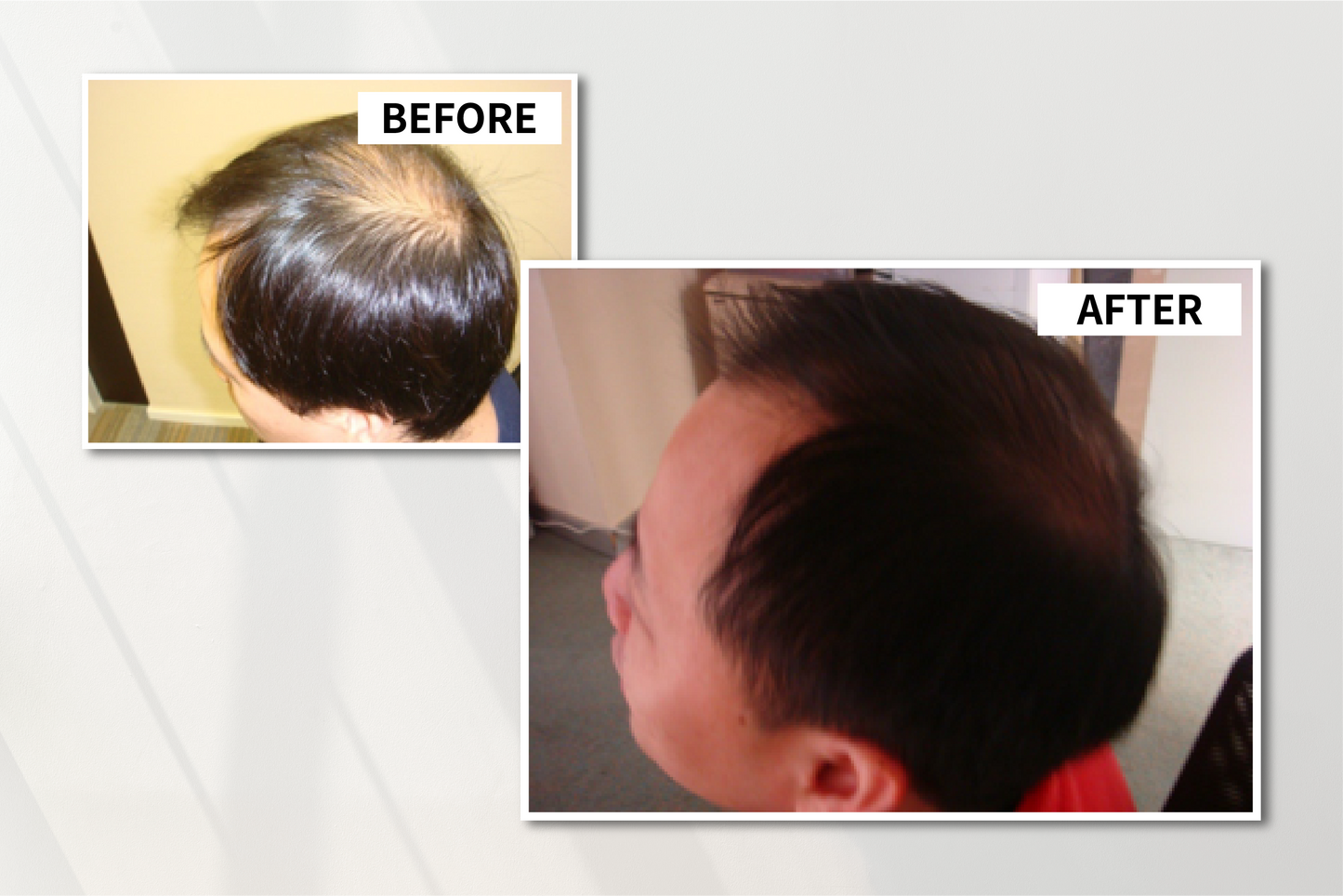 Anti-Hair-Loss Bio Scalp Restructuring Serum
