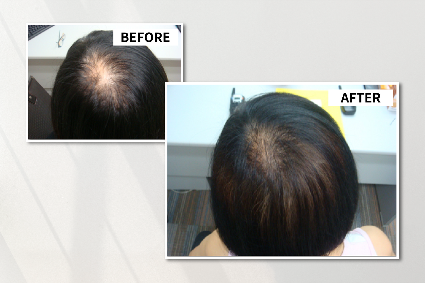 Anti-Hair-Loss Bio Scalp Restructuring Serum