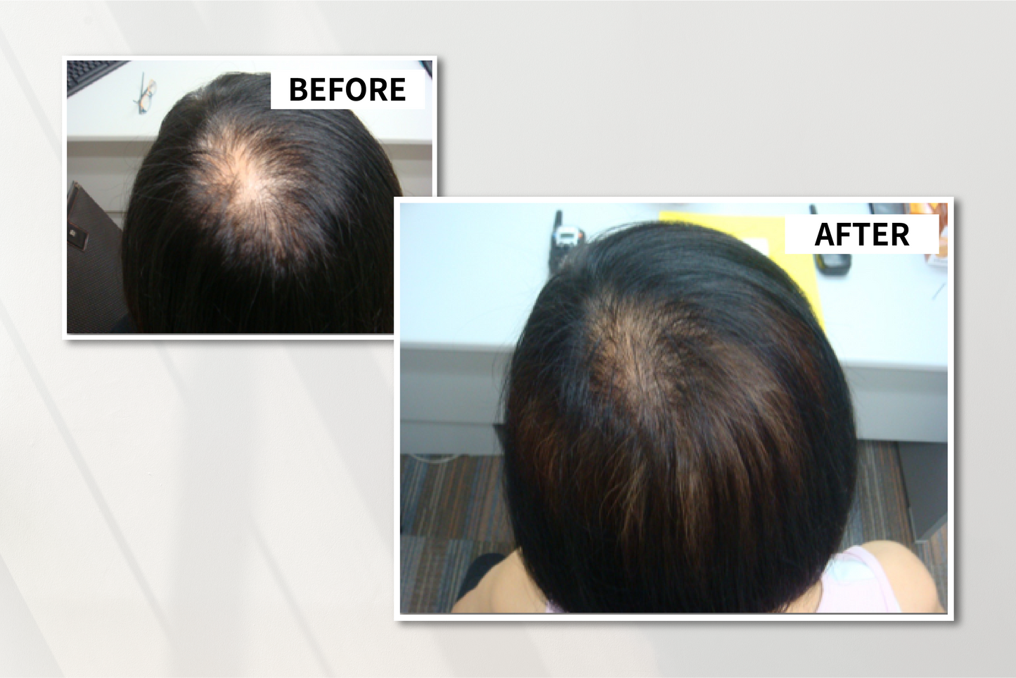 DrD 特效深層再生精華 Anti-Hair-Loss Bio Scalp Restructuring Serum