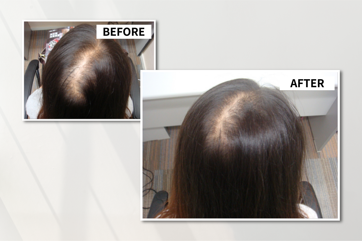 DrD 再生防脫髮洗髮露 Anti-Hair-Loss Follicle Revitalizing Shampoo