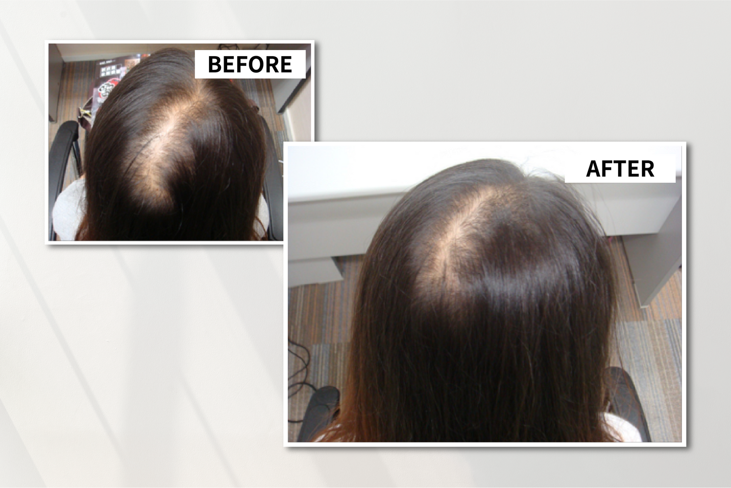Anti-Hair-Loss Anti-Breaking Treatment Conditioner